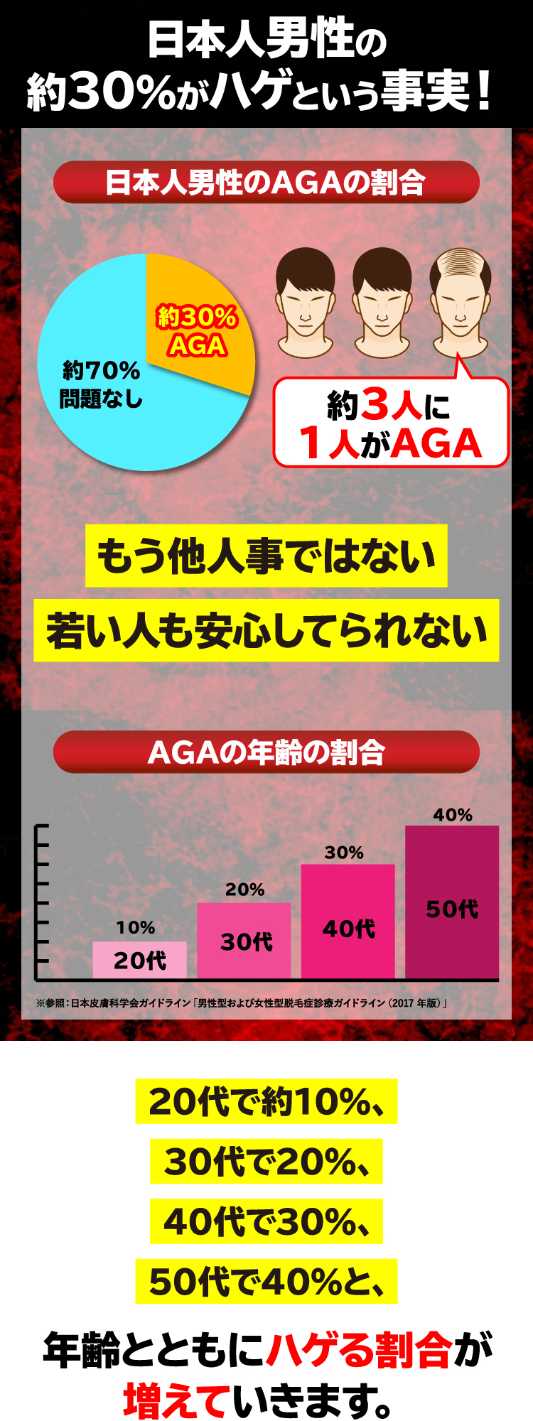 日本人男性の約30％がハゲという事実！